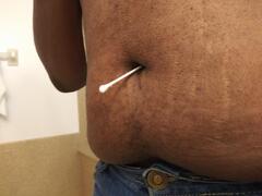 Swab Navel Check.jpg