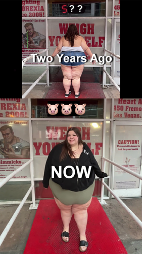 Heart Attack Grill before and after weight gain